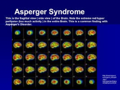 Sekcija za razvojnu psihologiju rane i pred&scaron;kolske dobi - poziv na sastanak 13.1.2017.