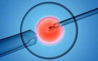 Sekcija za psihologiju razvojnih te&scaron;koća i invaliditeta - poziv na sastanak 2.2.23.